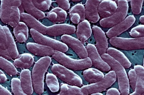 The Bayou State Confirms Five Fatalities from Necrotizing Bacteria in Coastal Waters
